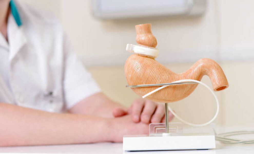 Bariátrica: más que por estética, por salud ante el Covid